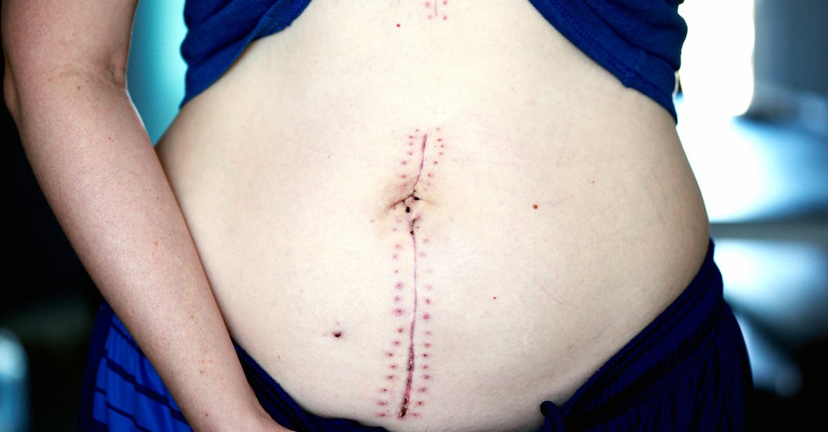 découvrez le pouvoir de la guérison avec nos techniques et approches variées. plongez dans un voyage de bien-être, apprenez à équilibrer votre esprit et votre corps, et transformez votre vie grâce à des méthodes de guérison ancestrales et modernes. explorez les bienfaits de la guérison holistique et trouvez votre chemin vers la sérénité.