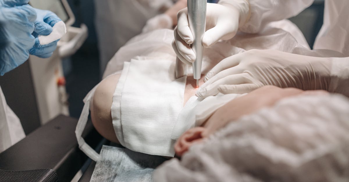 découvrez les dernières tendances et innovations en matière de chirurgie plastique. explorez les options disponibles pour améliorer votre apparence tout en garantissant des résultats sécurisés et naturels. informez-vous sur les procédures, les soins post-opératoires et les témoignages de patients satisfaits.